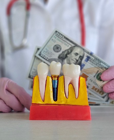dentist holding money behind a model of a dental implant
