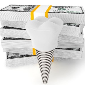 an illustration of how a dental implant in Keokuk could save you money